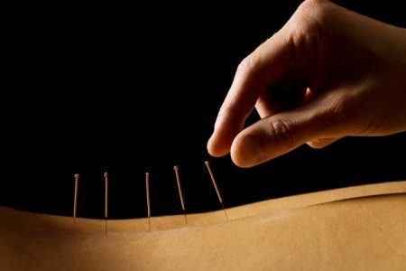 rygestop og akupunktur