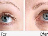 test af øjenvippe serum billede